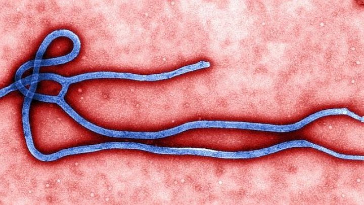 Premier transfert d’Ebola en Europe